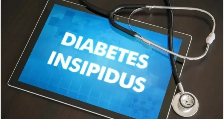 A Comprehensive Overview of Diabetes Insipidus